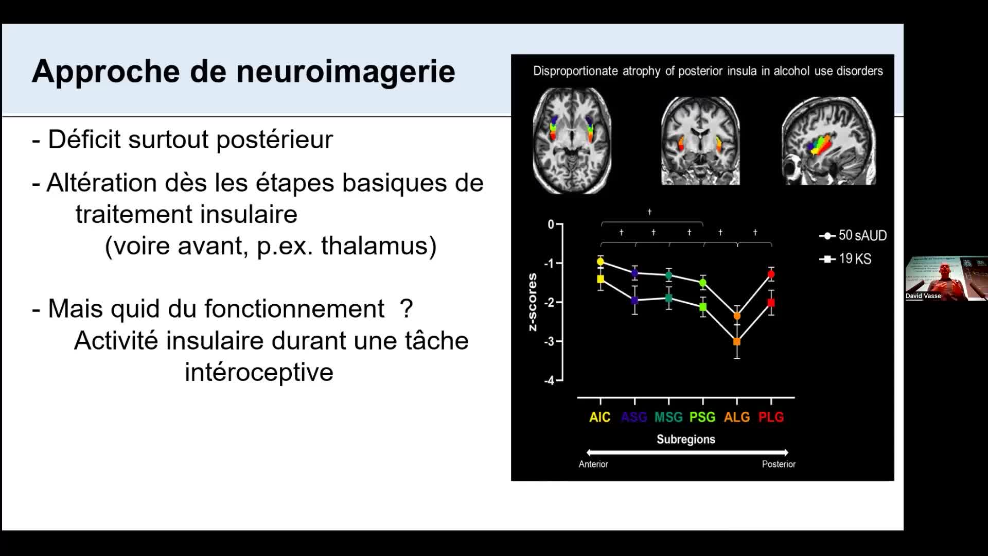 Séminaire Pierre Maurage | 05-Investiguer les interactions cerveau-corps
