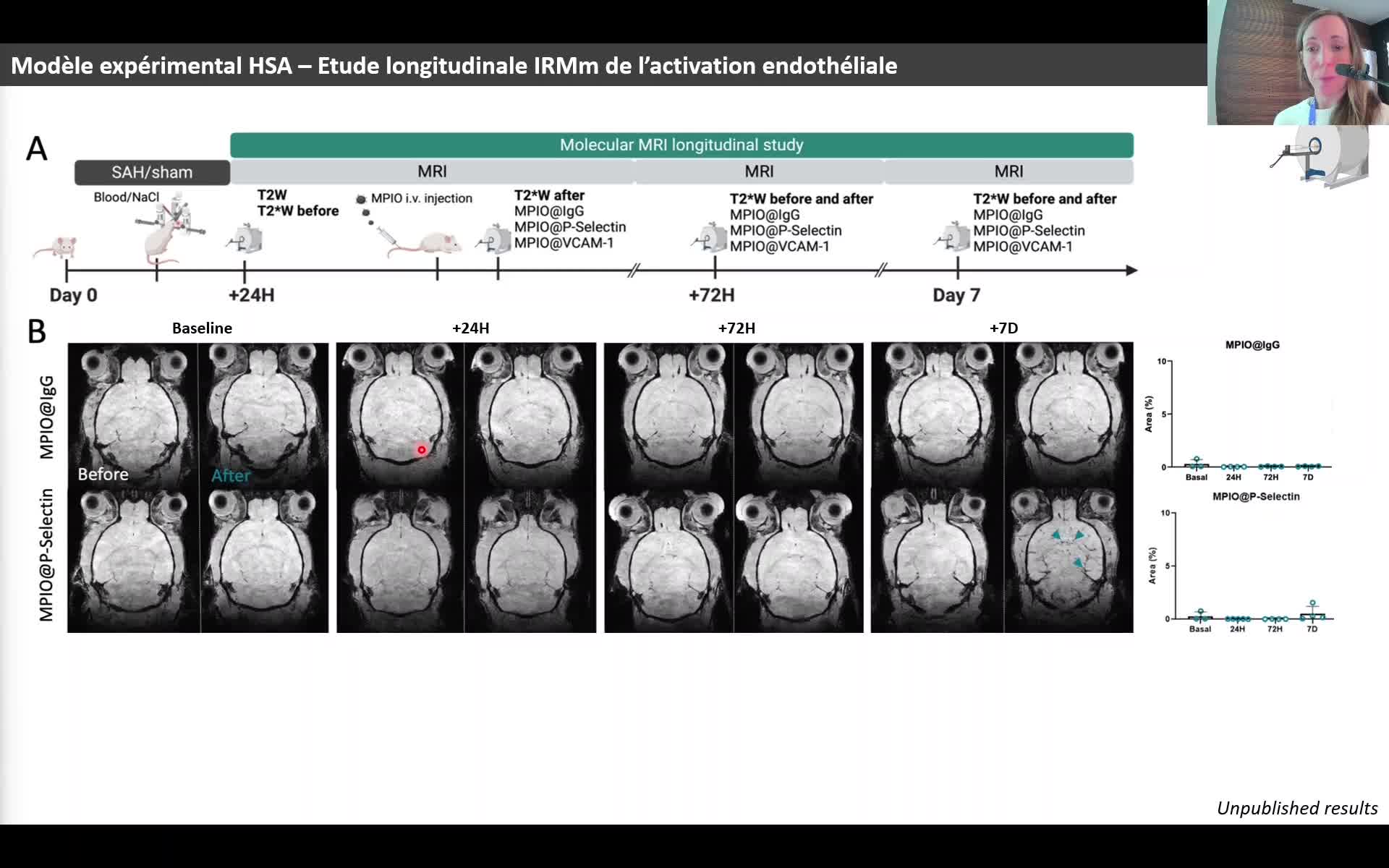 Multimodal molecular imaging of early brain injury in subarachnoid hemorrhage