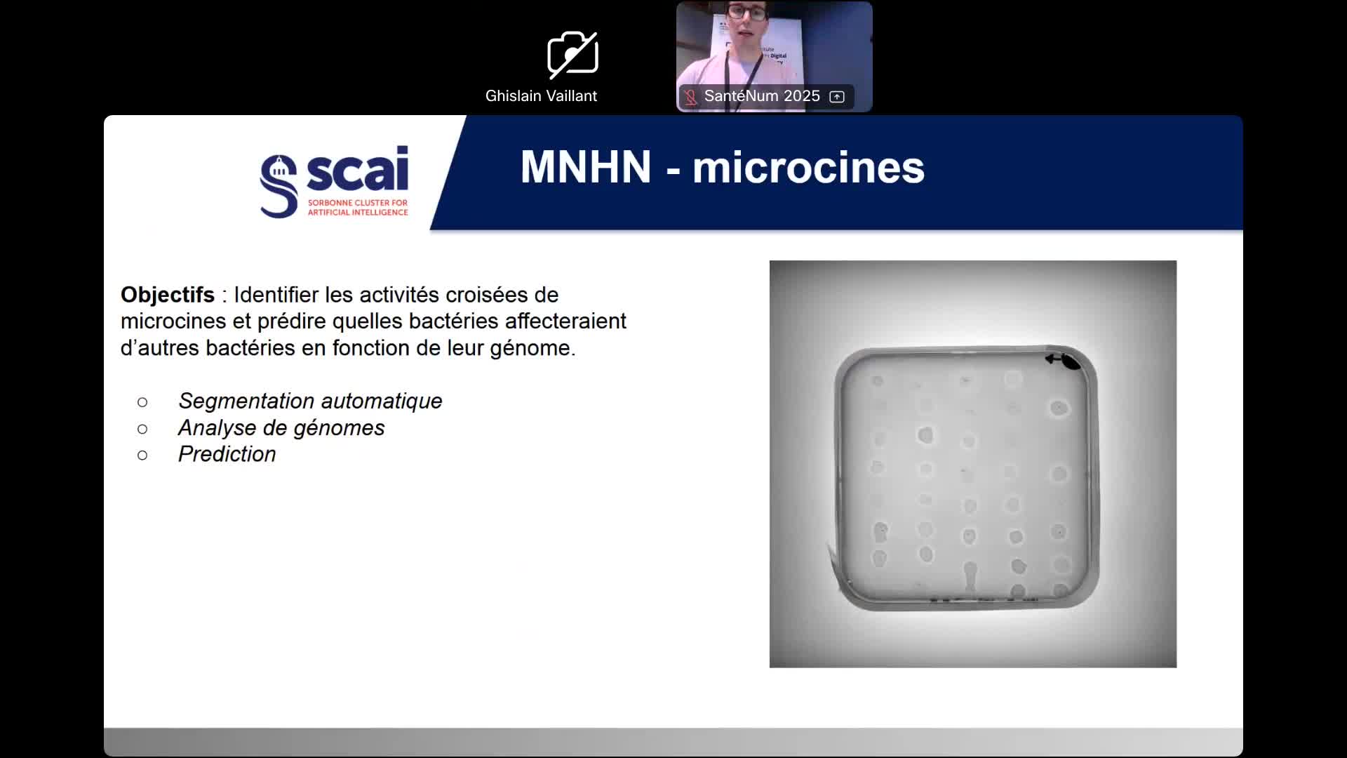 seminaire_santenum_2025_-_etienne_guevel_-_scai.webm