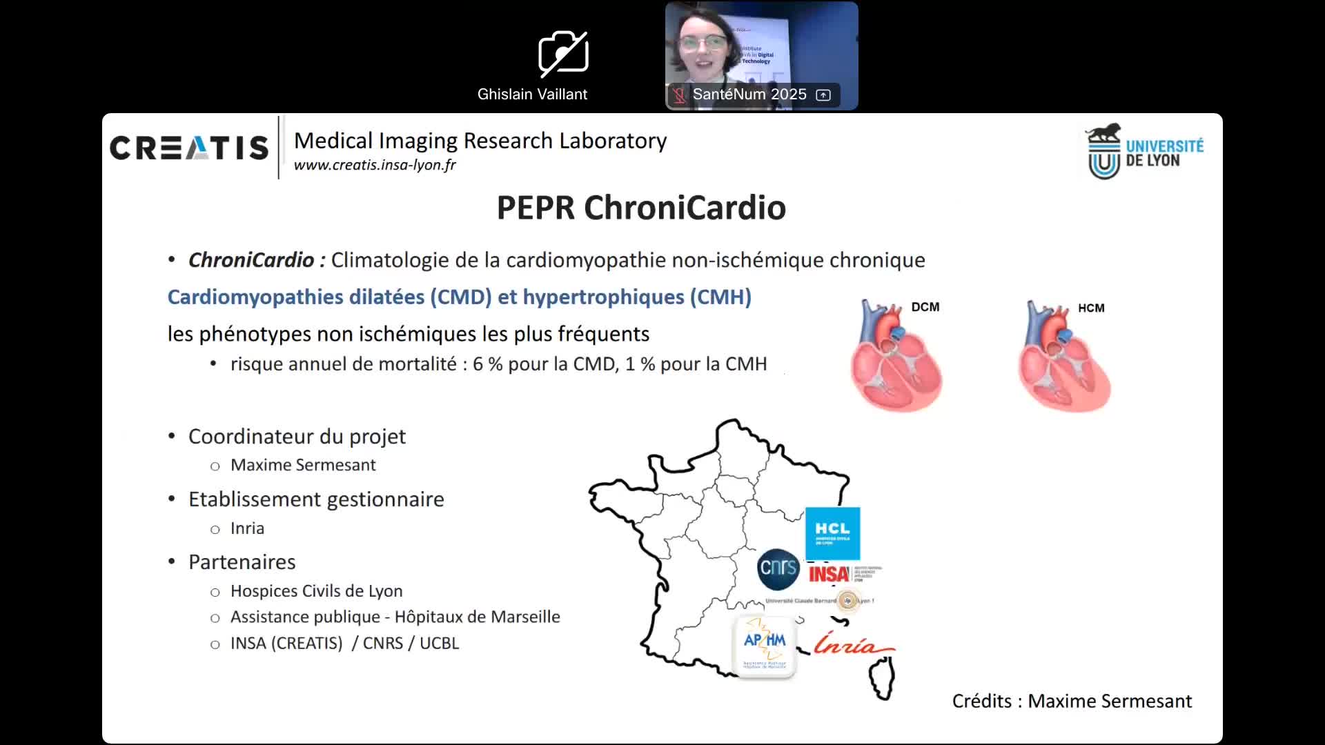 seminaire_santenum_2025_-_sorina_pop_-_virtual_imaging_platform.webm
