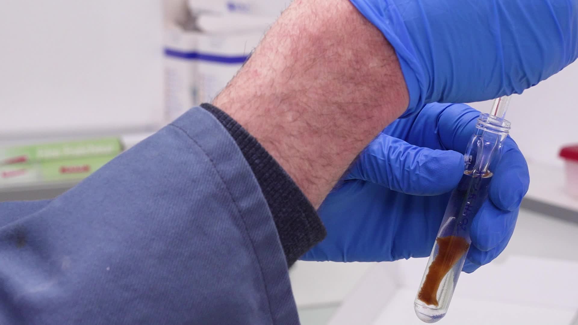 Tutoriel : Extraction du collagène par la méthode Acide–Base–Acide (ABA)