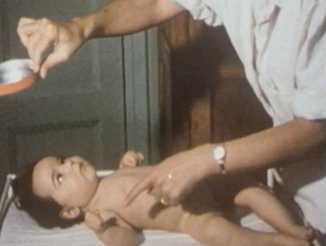 Apparition et évolution de l'infirmité motrice cérébrale chez le nourrisson (1979)