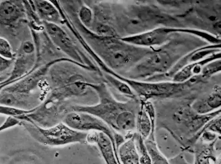 Morphologie cellulaire, mitoses et chromosomes dans une culture de môle hydatiforme