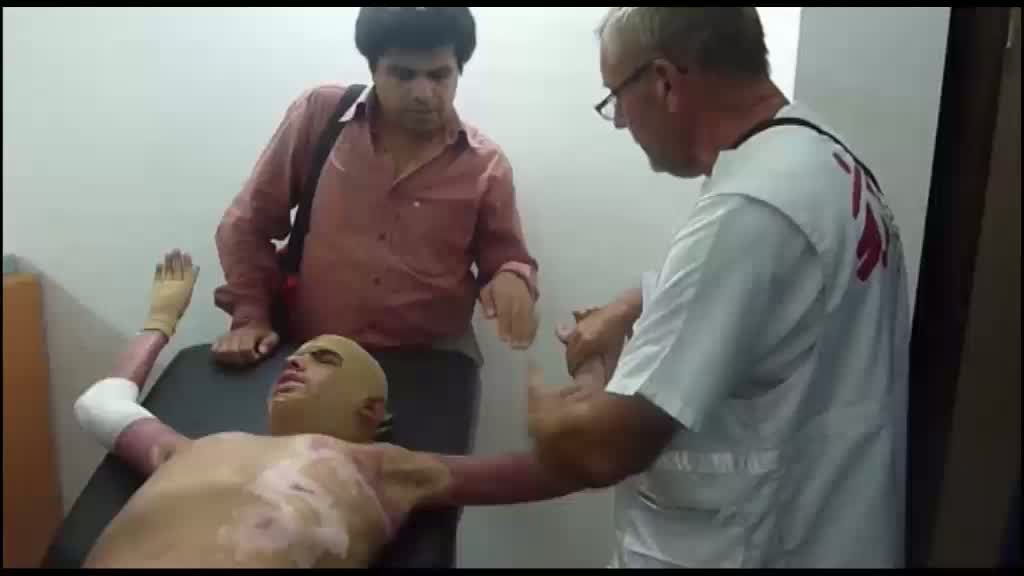 Médecins sans Frontière : physiothérapie des brulures à Gaza