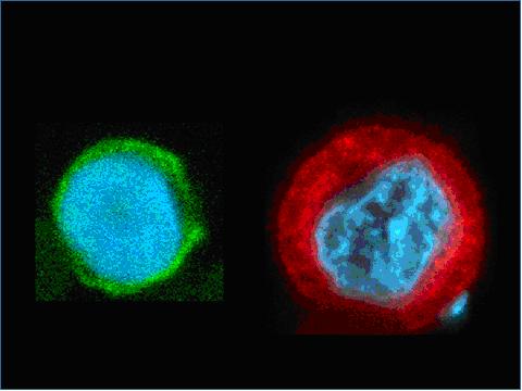 Un micro-billard à cellules pour combattre le cancer