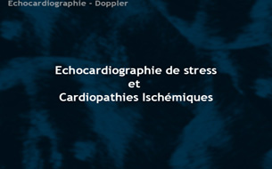 Échocardiographie de stress et cardiopathies ischémiques