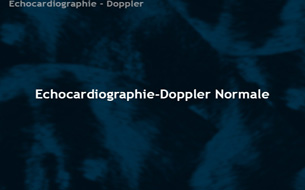 Échocardiographie-Doppler normale