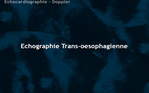 Échocardiographie trans-œsophagienne
