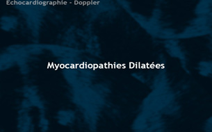 Myocardiopathies dilatées