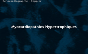 Myocardiopathies hypertrophiques