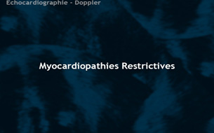 Myocardiopathies restrictives