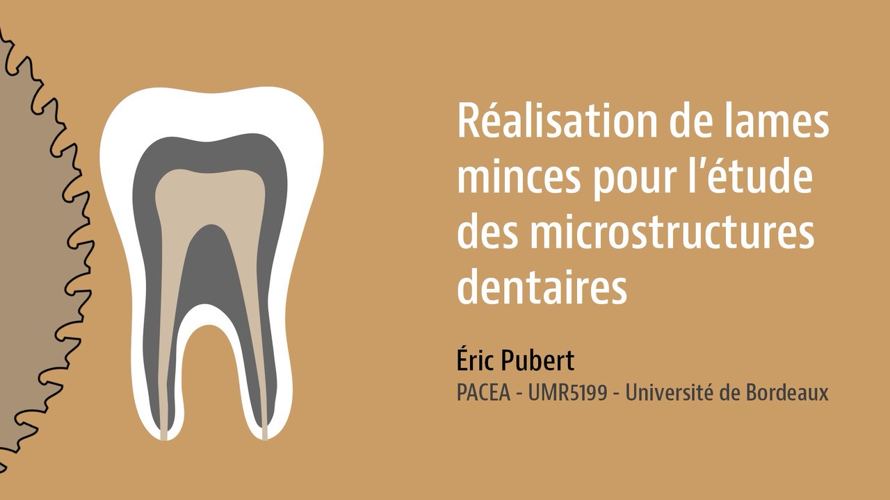 Réalisations de lames minces pour l'étude des microstructures dentaires