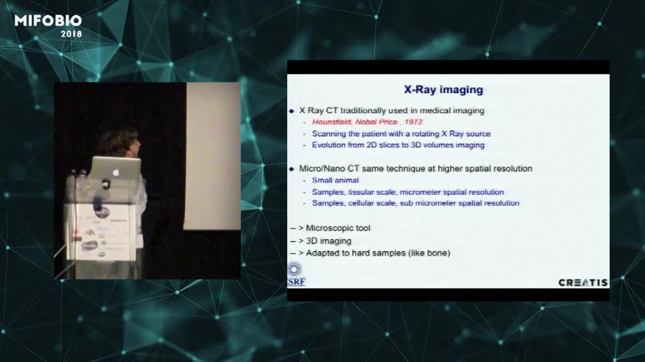 3D X-ray microscopy by absorption and phase Computerized Tomography - Françoise Peyrin