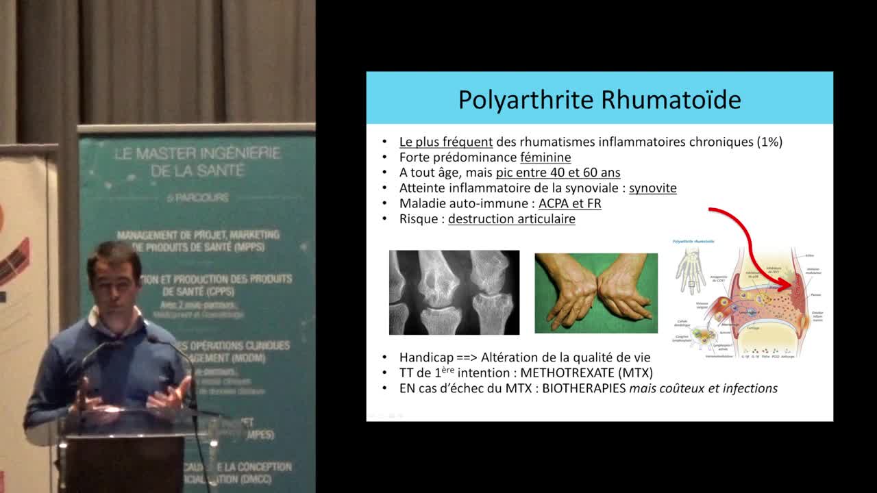 Suivi de patients atteints de polyarthrite rhumatoïde : intérêt d'une application pour Smartphone