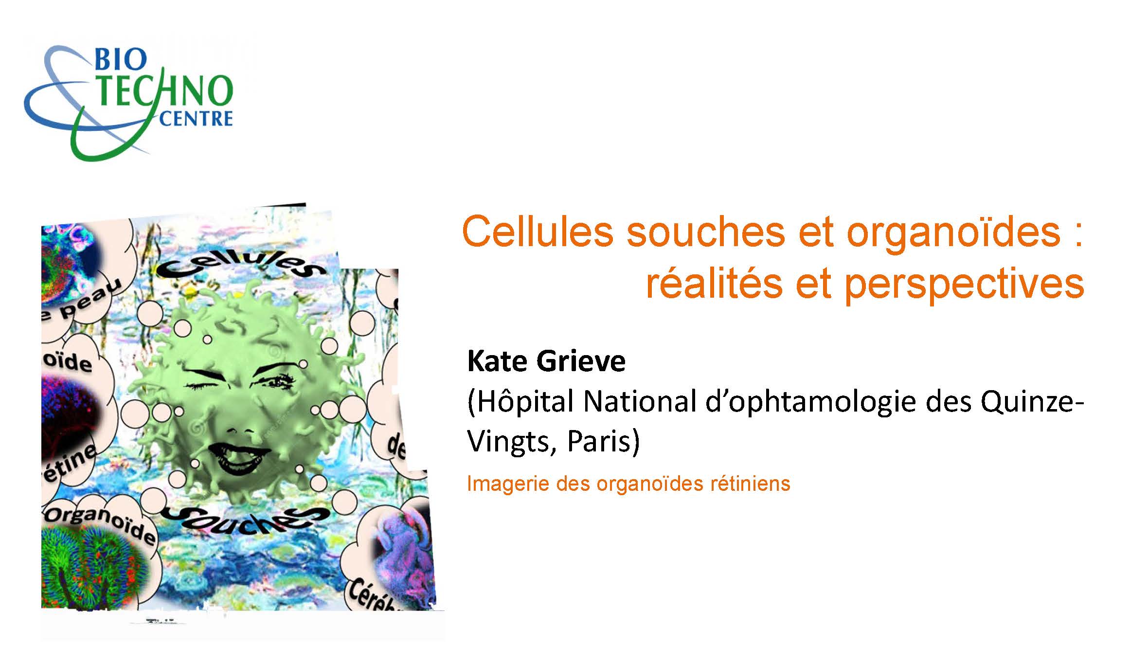 Kate Grieve - Imagerie des organoïdes rétiniens