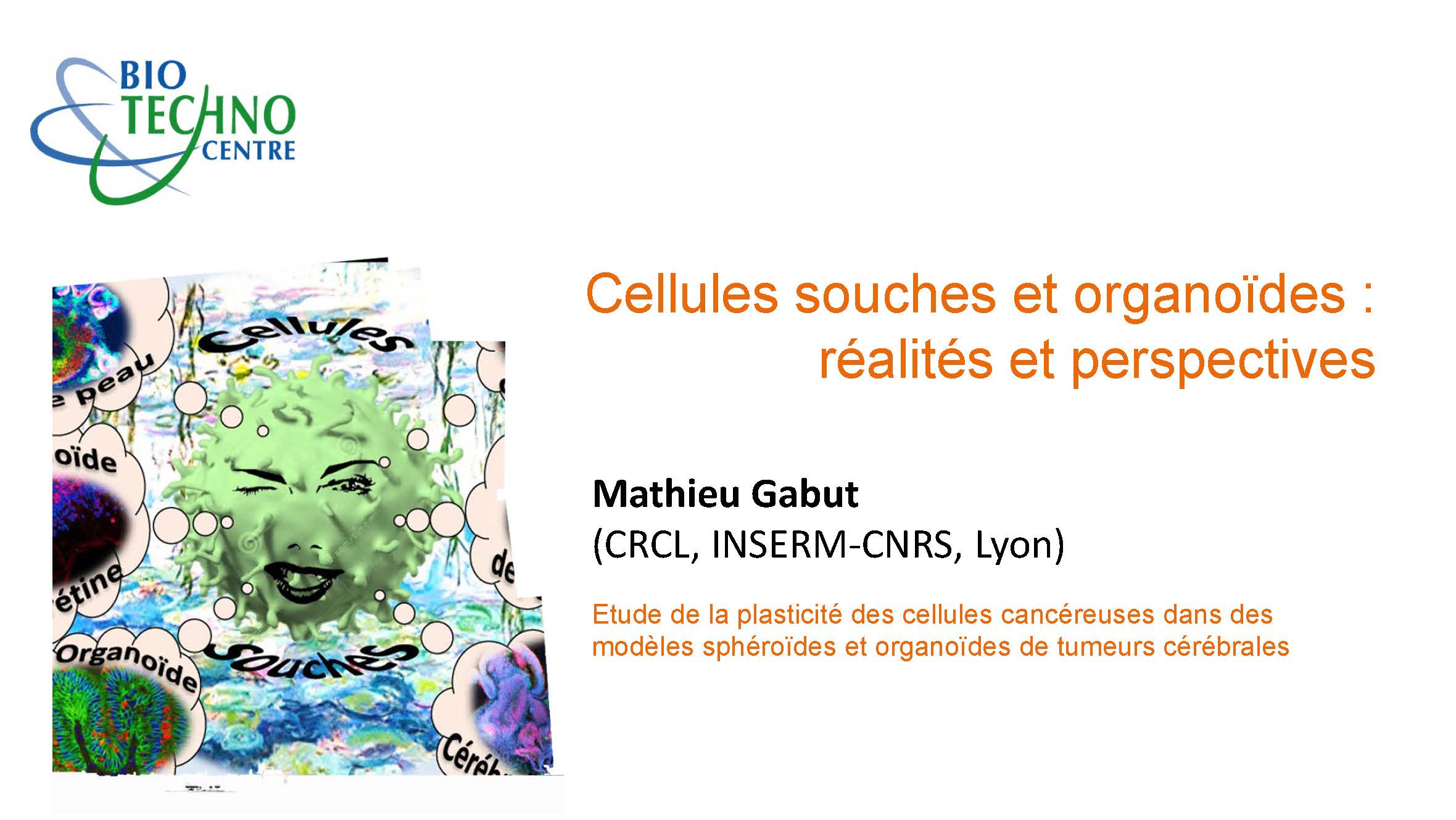 Mathieu Gabut - Modèles d'études 3D des cellules souches cancéreuses de tumeurs cérébrales