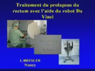 Première journée francophone de chirurgie robotique - prolapsus rectal