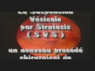 La suspension vésicale par stratatis (SVS) : un nouveau procédé chirurgical de traitement de l'incontinence urinaire d'effort associé à un trouble statique de la femme