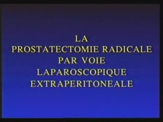 Prostatectomie radicale par voie laparoscopique extrapéritonéale