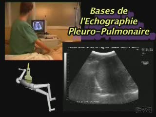 Echographie pleuro-pulmonaire en réanimation.