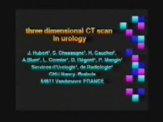Le scanner avec reconstruction tridimensionnelle de surface (3DS) en urologie. Technique. Résultats.