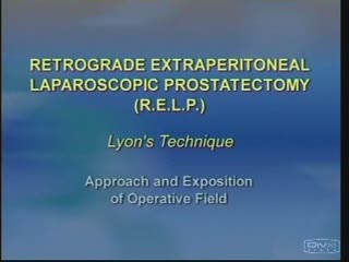 Prostatectomie extrapéritonéale et rétrograde laparoscopique ( P.E.R.L.) : abord et exposition du champ opératoire
