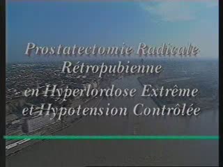Prostatectomie radicale rétropubienne en hyperlordose extrême et hypotension contrôlée