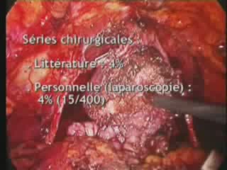 Caractéristiques anatomiques et dissection des artères honteuses internes accessoires