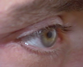 Examens oculaires de base : (2) les examens de la morphologie de l'oeil
