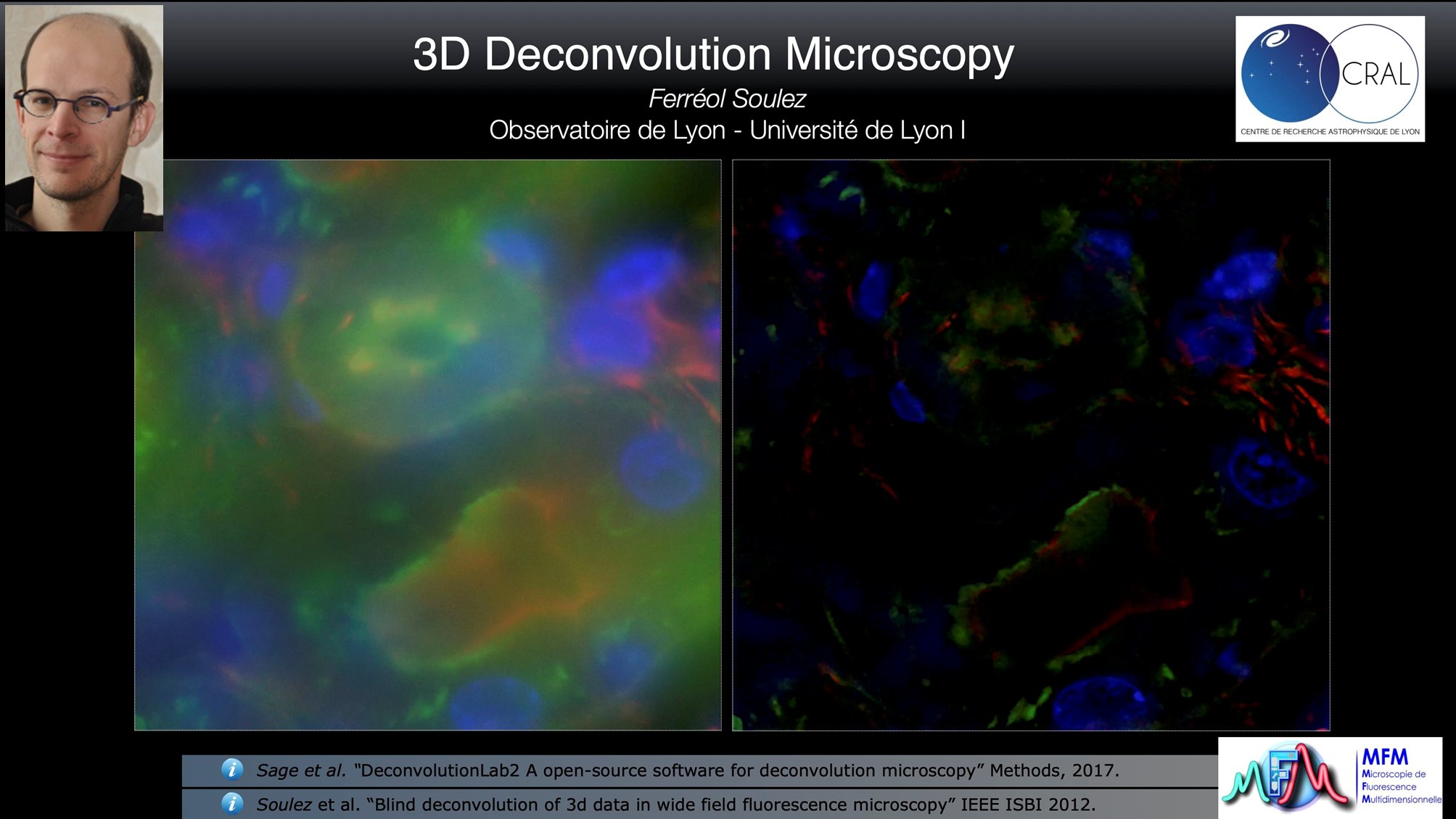 3D Deconvolution Microscopy
