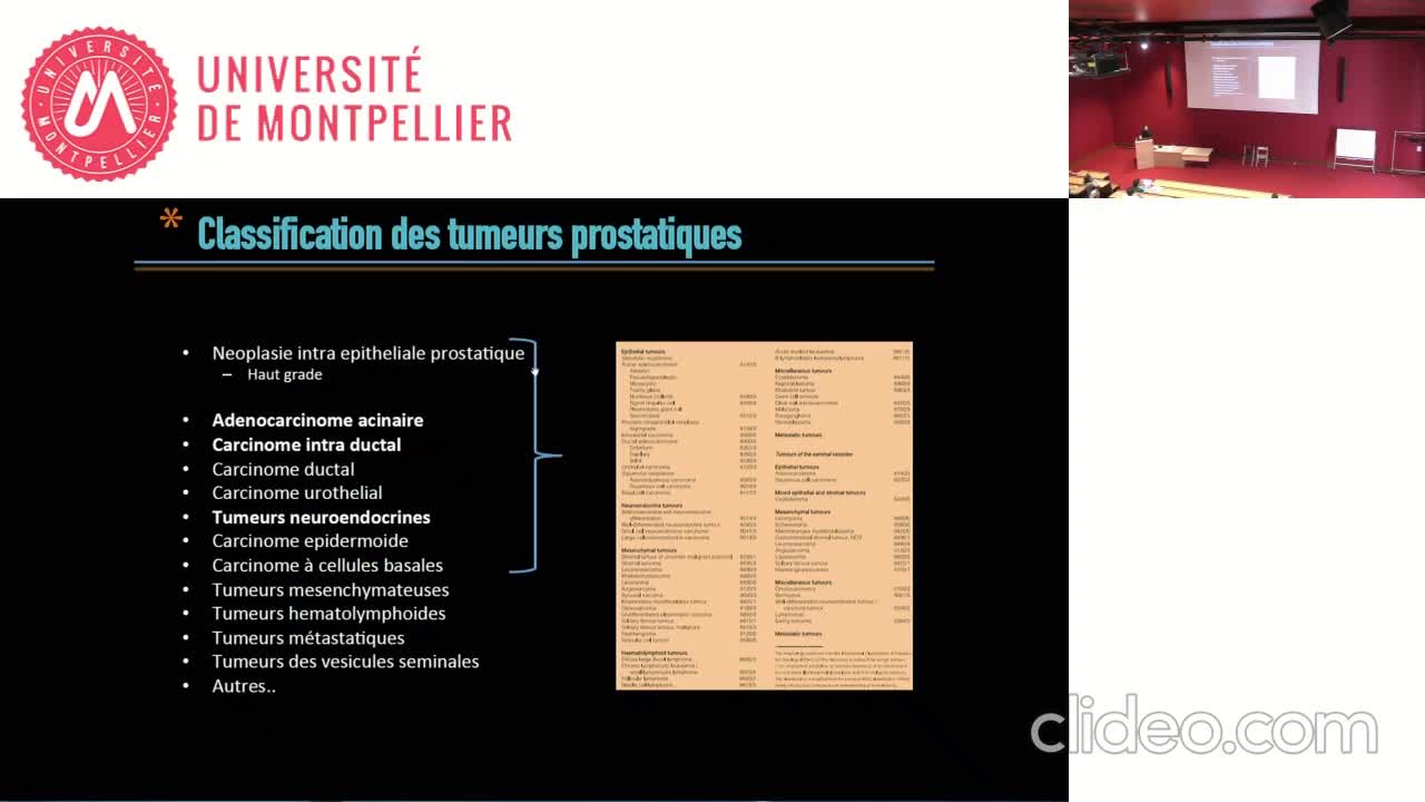 SFJRO Montpellier 2019 - Classification anatomopathologique