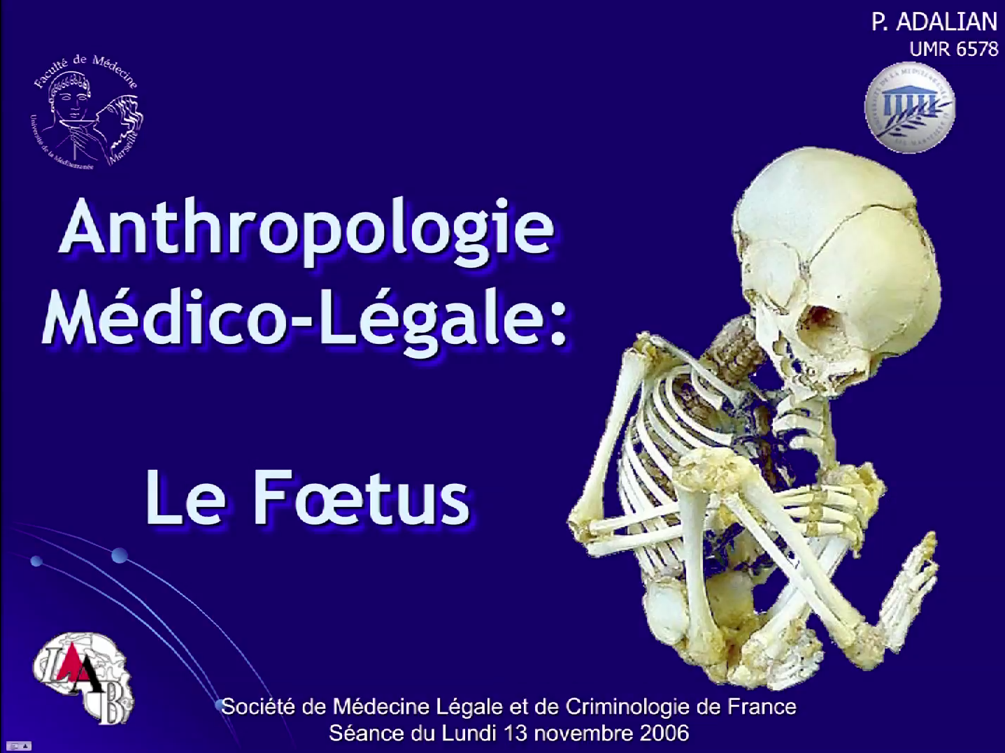20 entretiens en Anthropologie Bio Culturelle : Médecine légale et anthropologie - Foetus