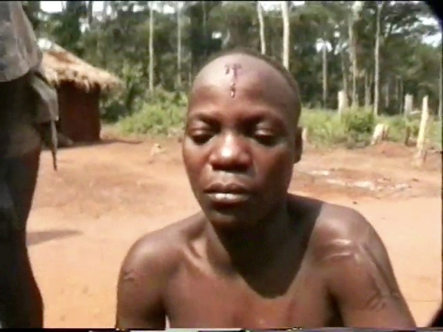 Chronique aka, Akungu décembre 1994 : cure de la migraine de Bonéné et histoire de la folie de Koti
