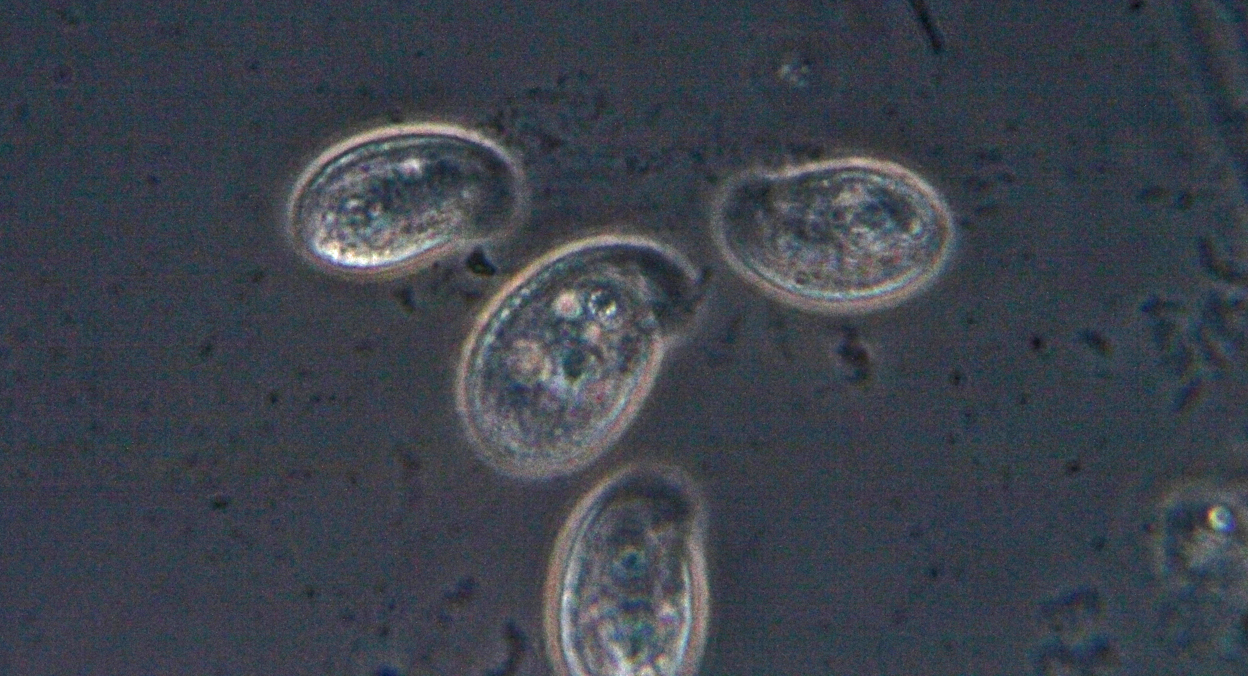 Chilodonella, petit cilié disymétrique