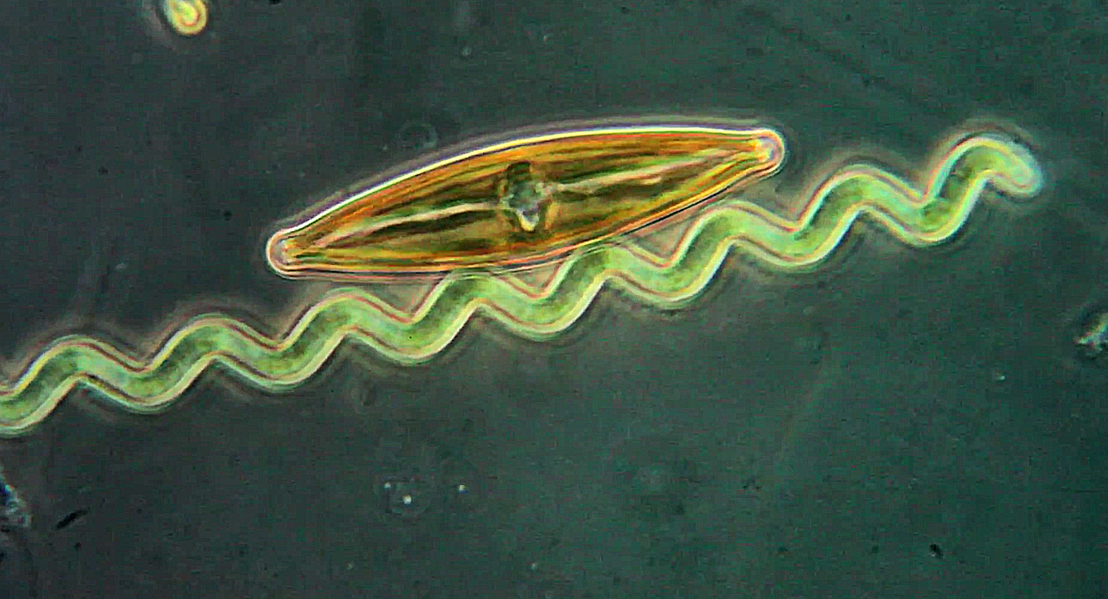 La cyanobactérie et la diatomée