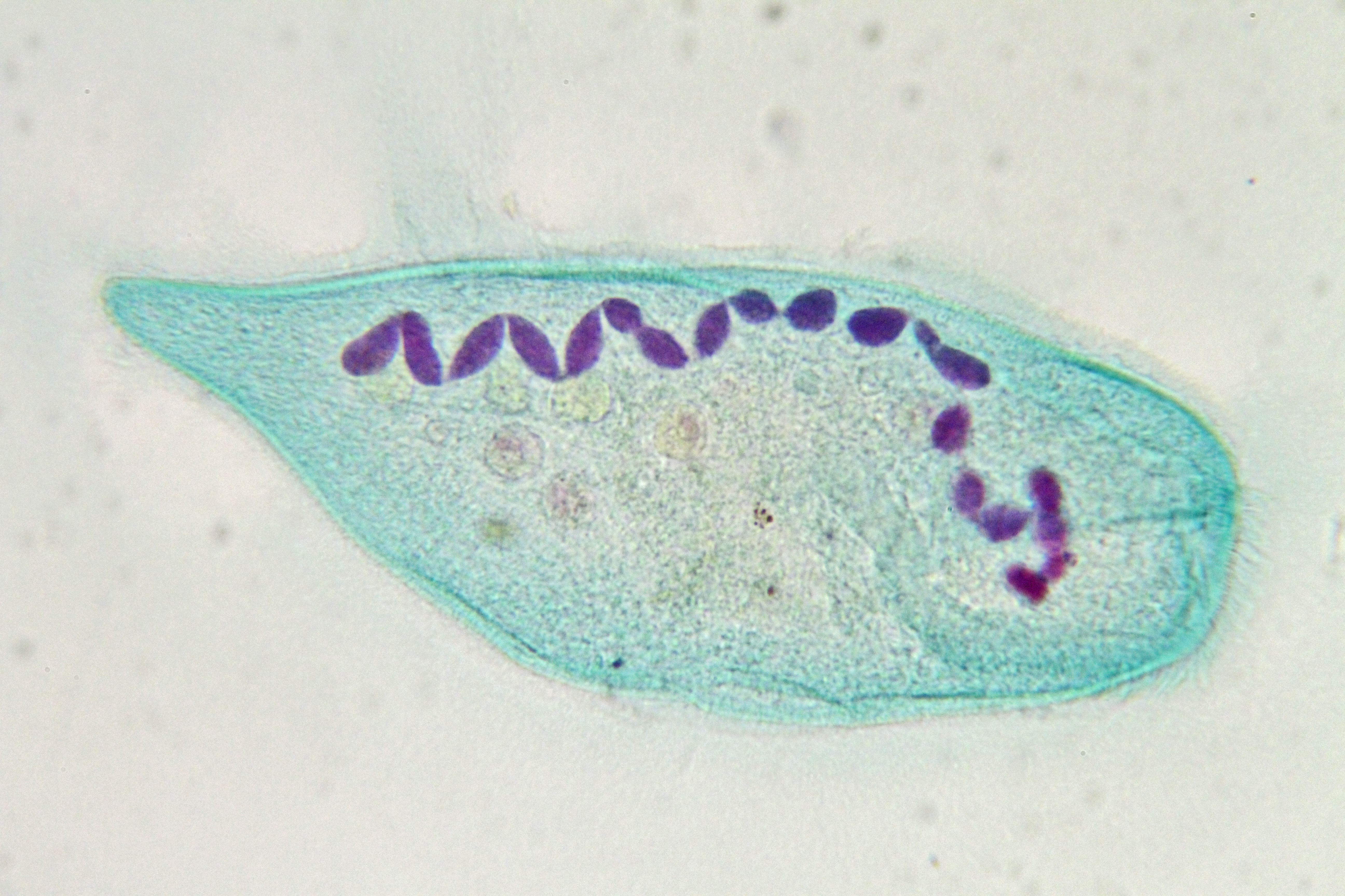 Le noyau moniliforme des ciliés