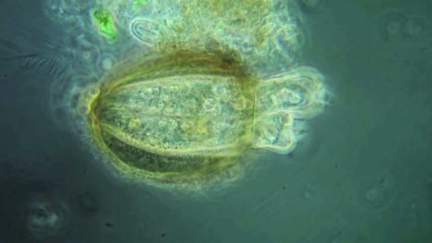 Platycola decumbens, cilié péritriche avec lorica