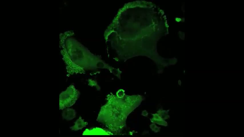 Relation entre les microtubules et la distribution des podosomes