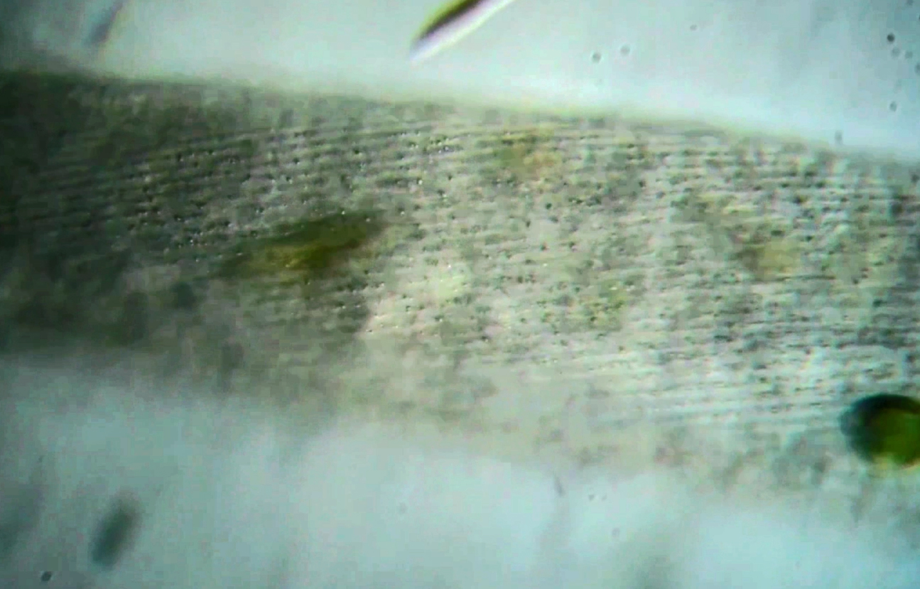 Spirostomum ambiguum, la ciliature (1)