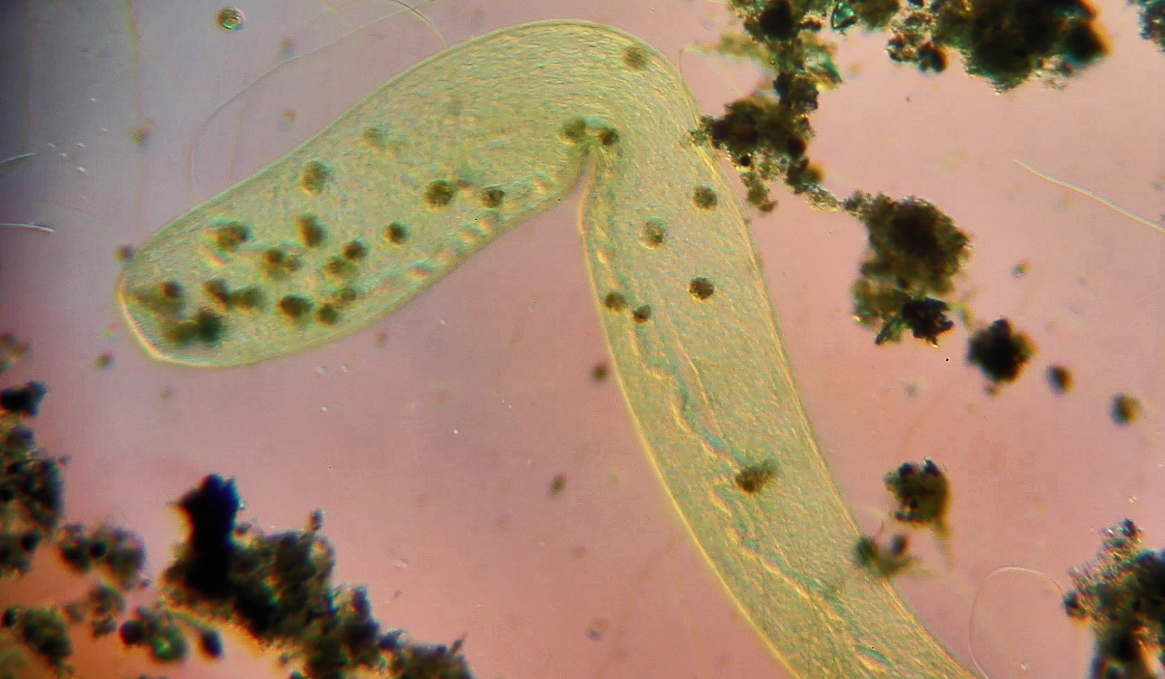 Spirostomum, la souplesse d'un cilié géant