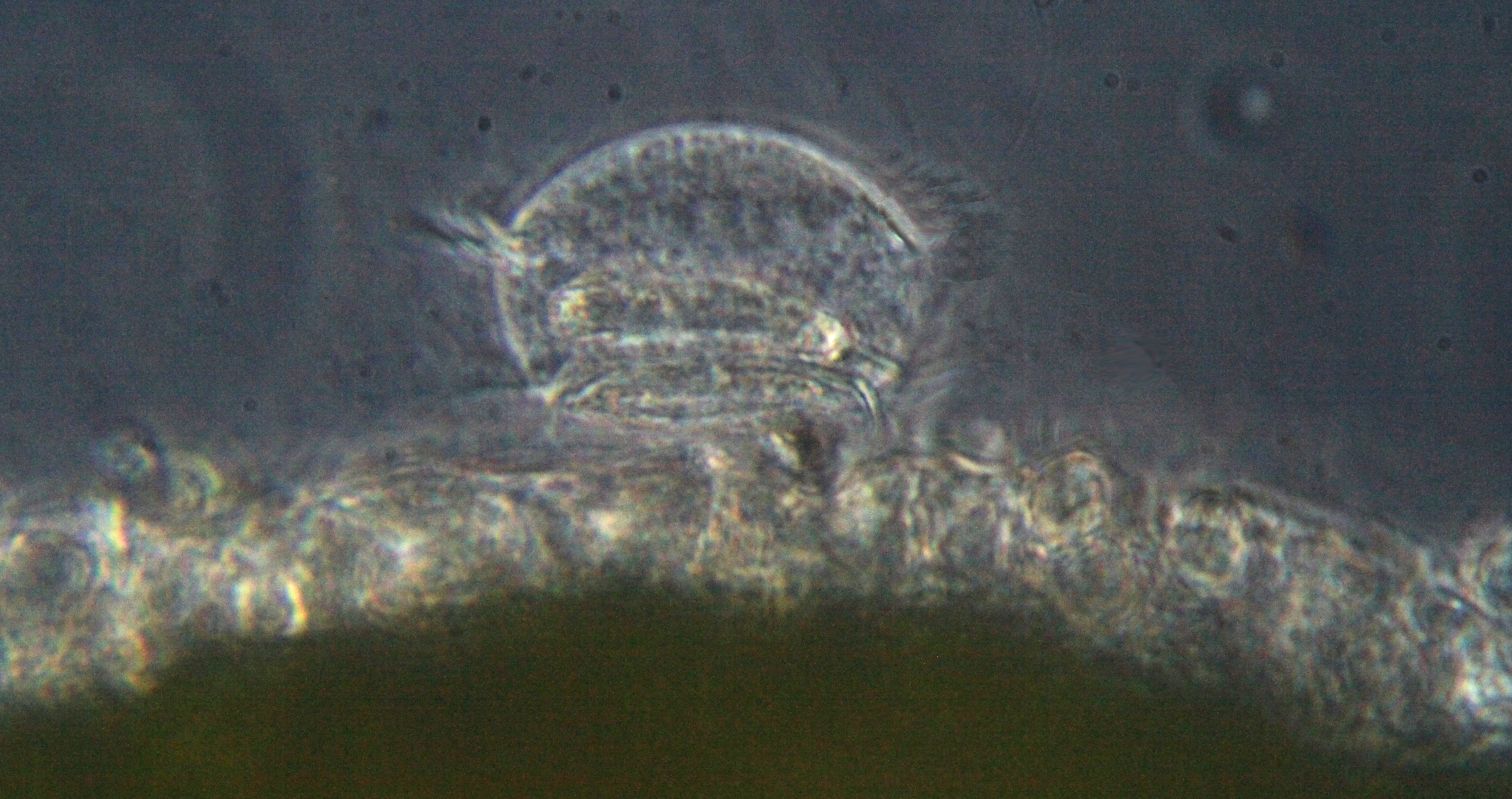 Trichodina pediculus, cilié commensal des hydres vertes