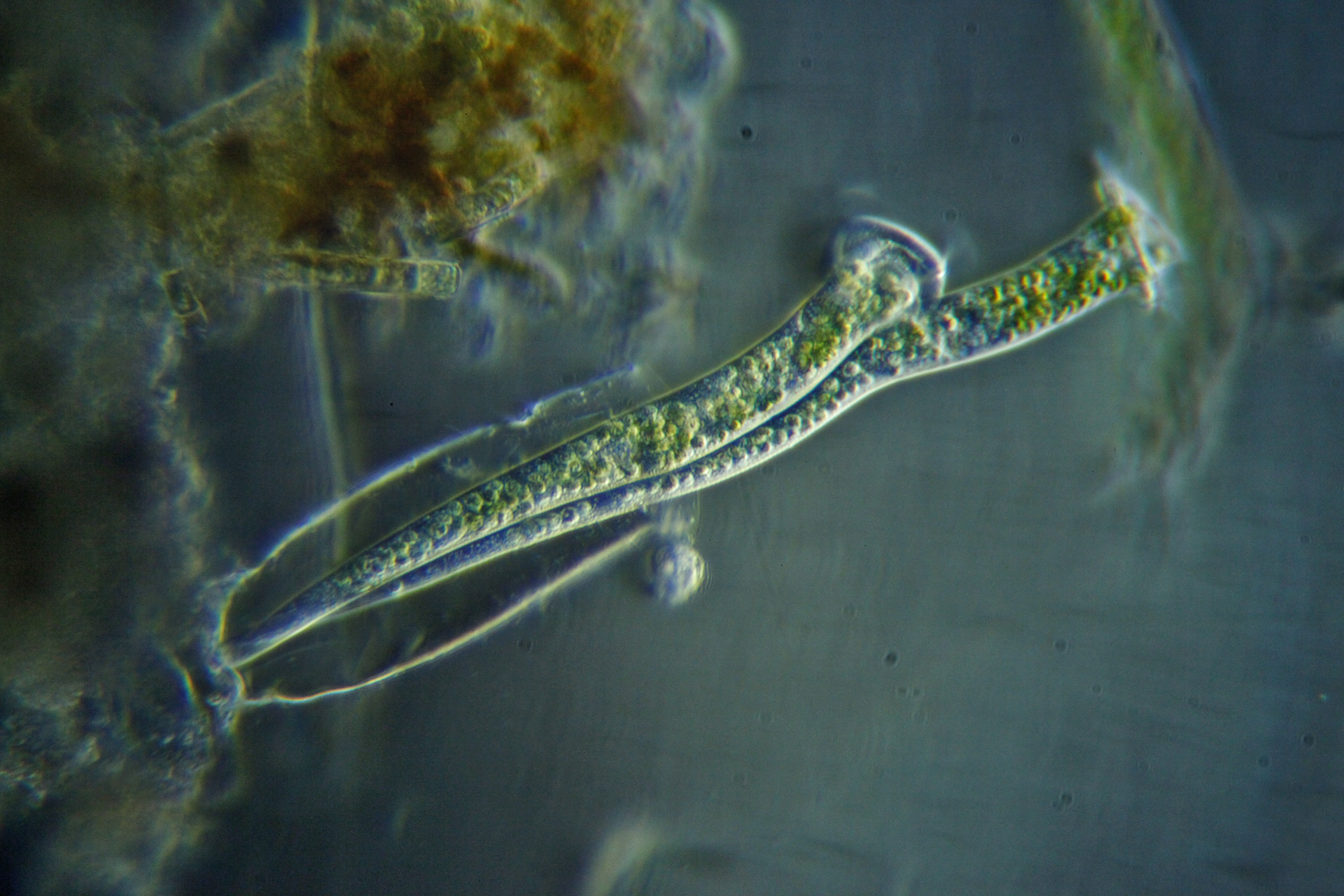 Vaginicola subcrystallina, les frères ciliés