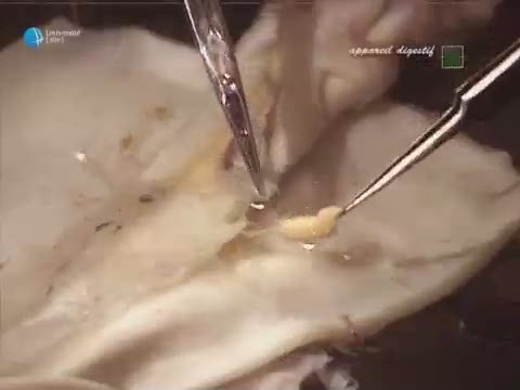 Biologie Animale, la dissection du calmar, 5 - appareil digestif