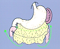 Gastrectomie totale pour maladie de ménétrier (viscérosynthèse)