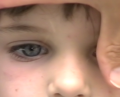 Examens oculaires de base : (3) les examens oculaires chez l'enfant
