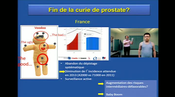 COURS SFJRO CURIE 2016 - Nouvelles indications de la curiethérapie de prostate : Pr Gilles CRÉHANGE