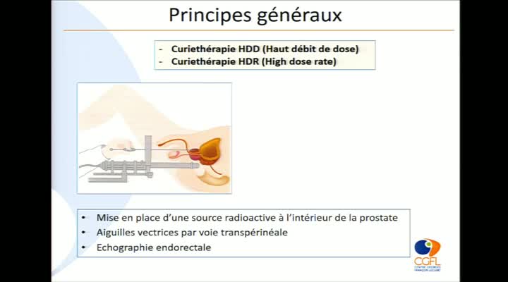 COURS SFJRO CURIE 2016 - Technique, indications et résultats/implants temporaires : Dr Etienne MARTIN